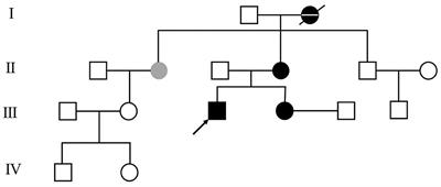 Case Report: Clinical Outcome From Pallidal Stimulation in a Patient With Levodopa-Resistant Dopa-Responsive Dystonia